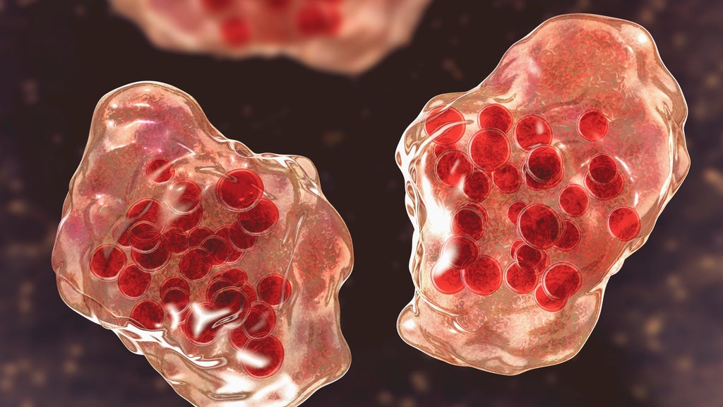 Central Minnesota county reports "several cases of suspected measles" — WCCO / CBS Minnesota, Medina Health news