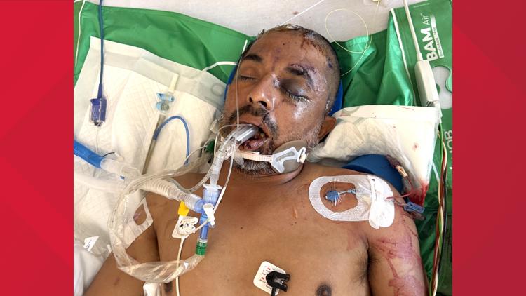 University Hospital asks for help identifying unconscious patient hit by truck Saturday evening — KENS 5 (San Antonio), Medina Health news