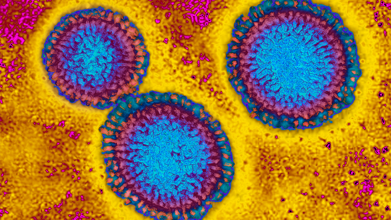 Flu hospitalizations 'slightly higher' than usual, officials urge vaccinations — FOX 9, Medina Health news